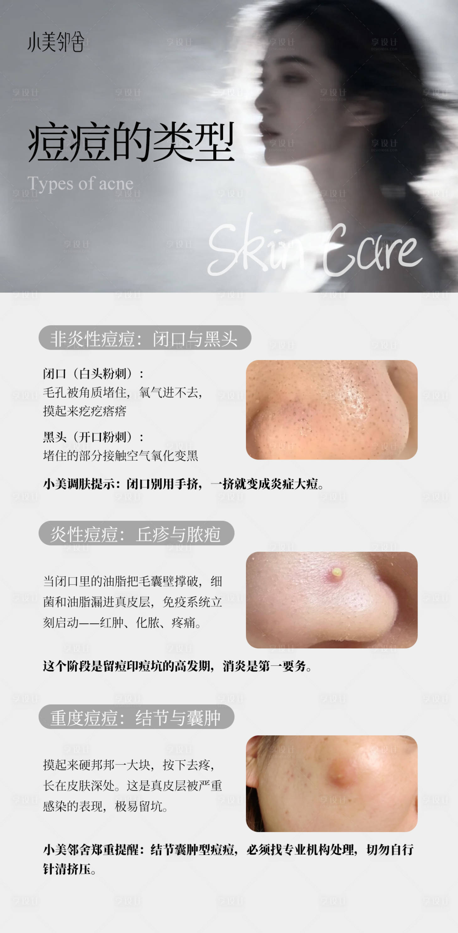 源文件下载【享设计】搜索编号：22120036848613571【高级护肤品海报护肤专业知识】