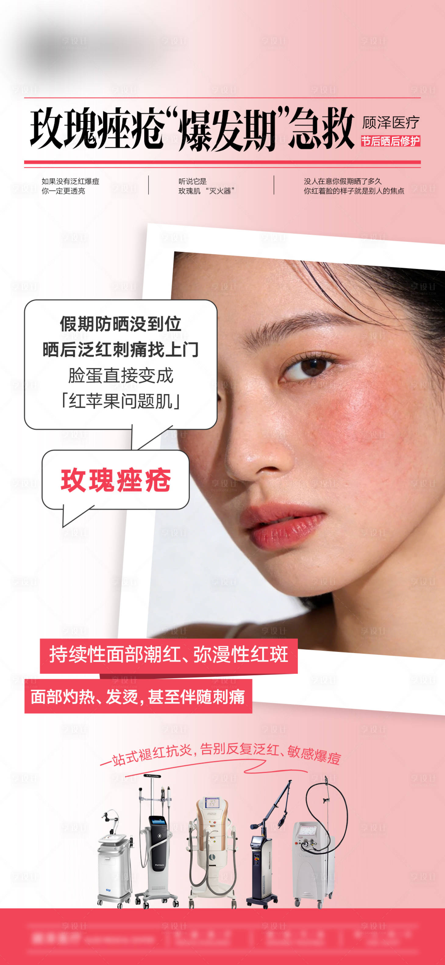 源文件下载【享设计】搜索编号：54370036706889717【玫瑰痤疮 “爆发期” 急救】