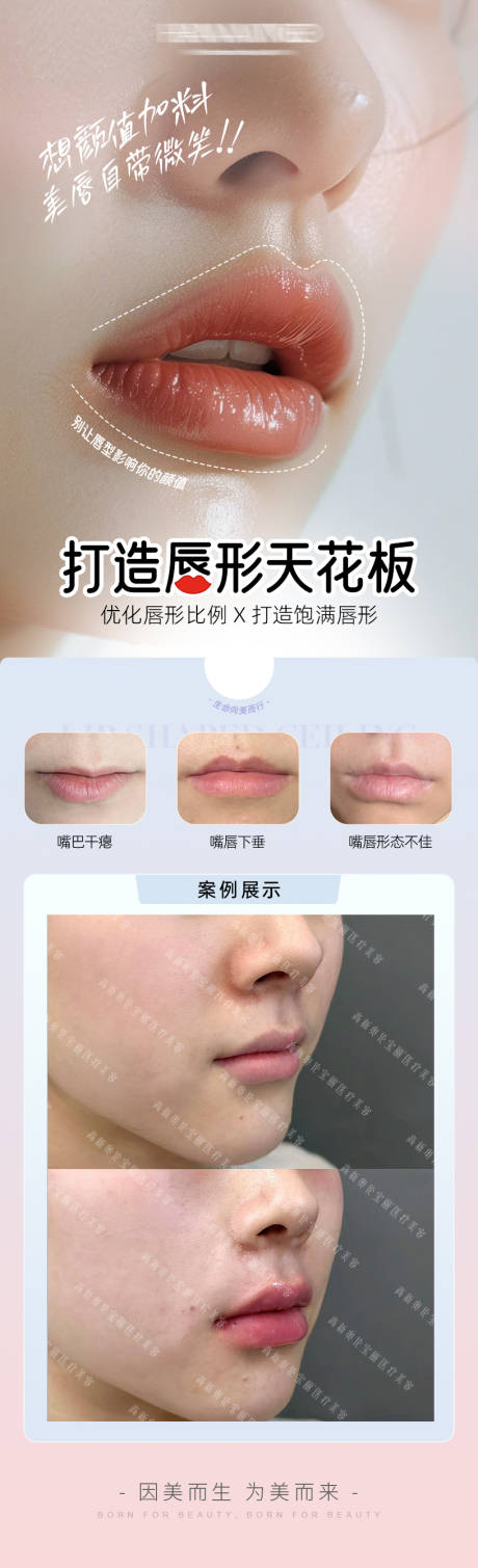源文件下载【享设计】搜索编号：54610036666887345【医美嘴唇口周美学案例海报】
