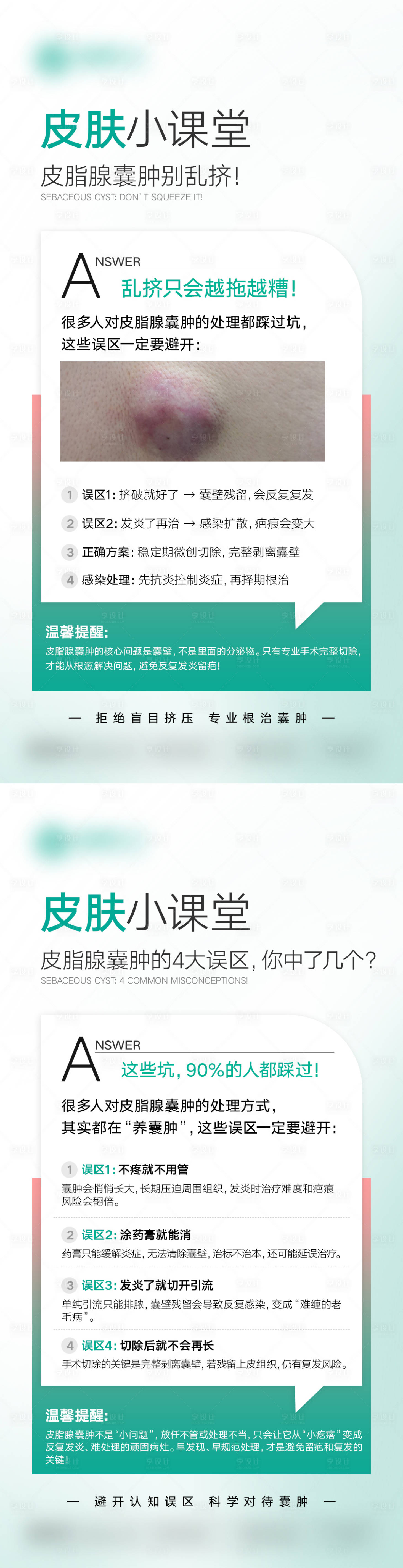 源文件下载【享设计】搜索编号：42720036707076479【皮脂腺囊肿的4大误区科普】