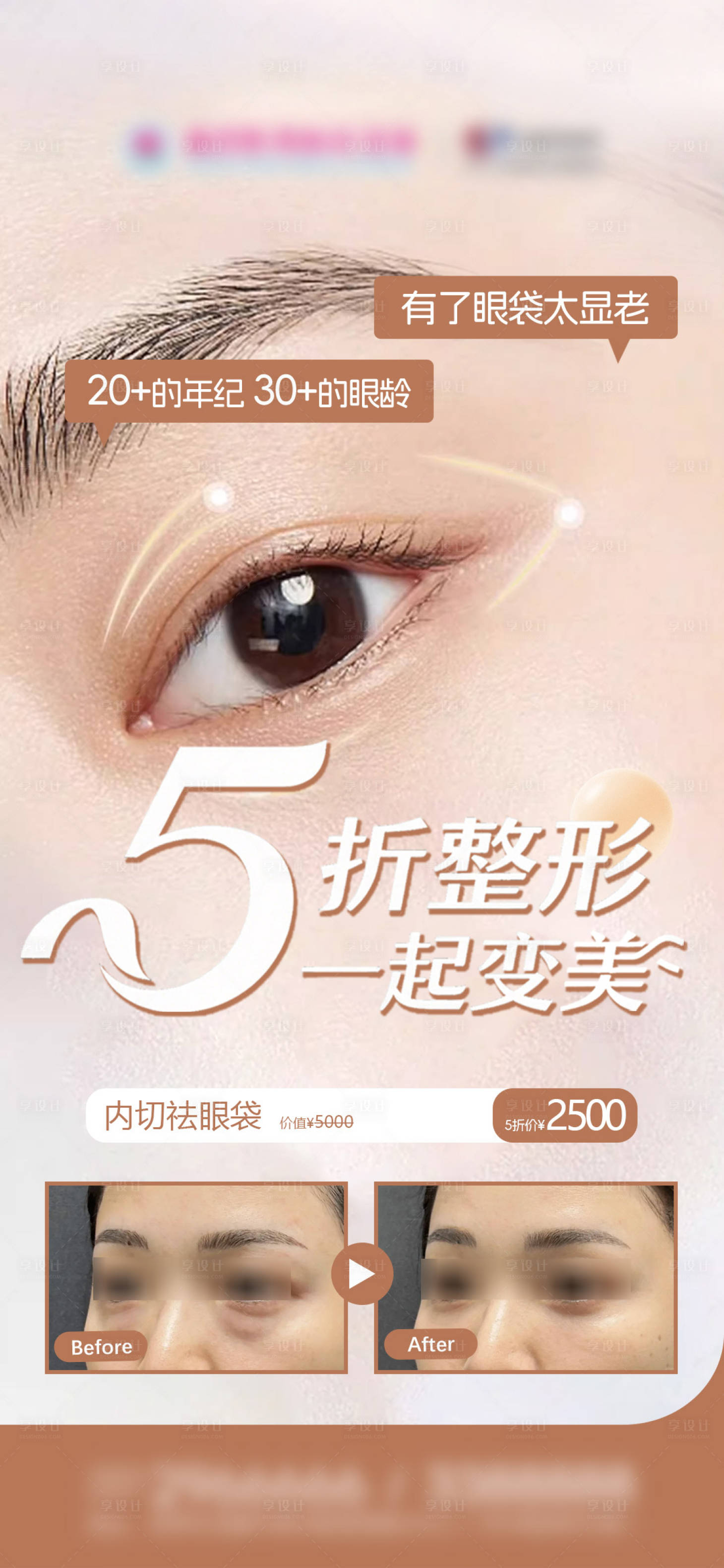 源文件下载【享设计】搜索编号：71320036668771988【医美祛眼袋案例对比及优惠海报】