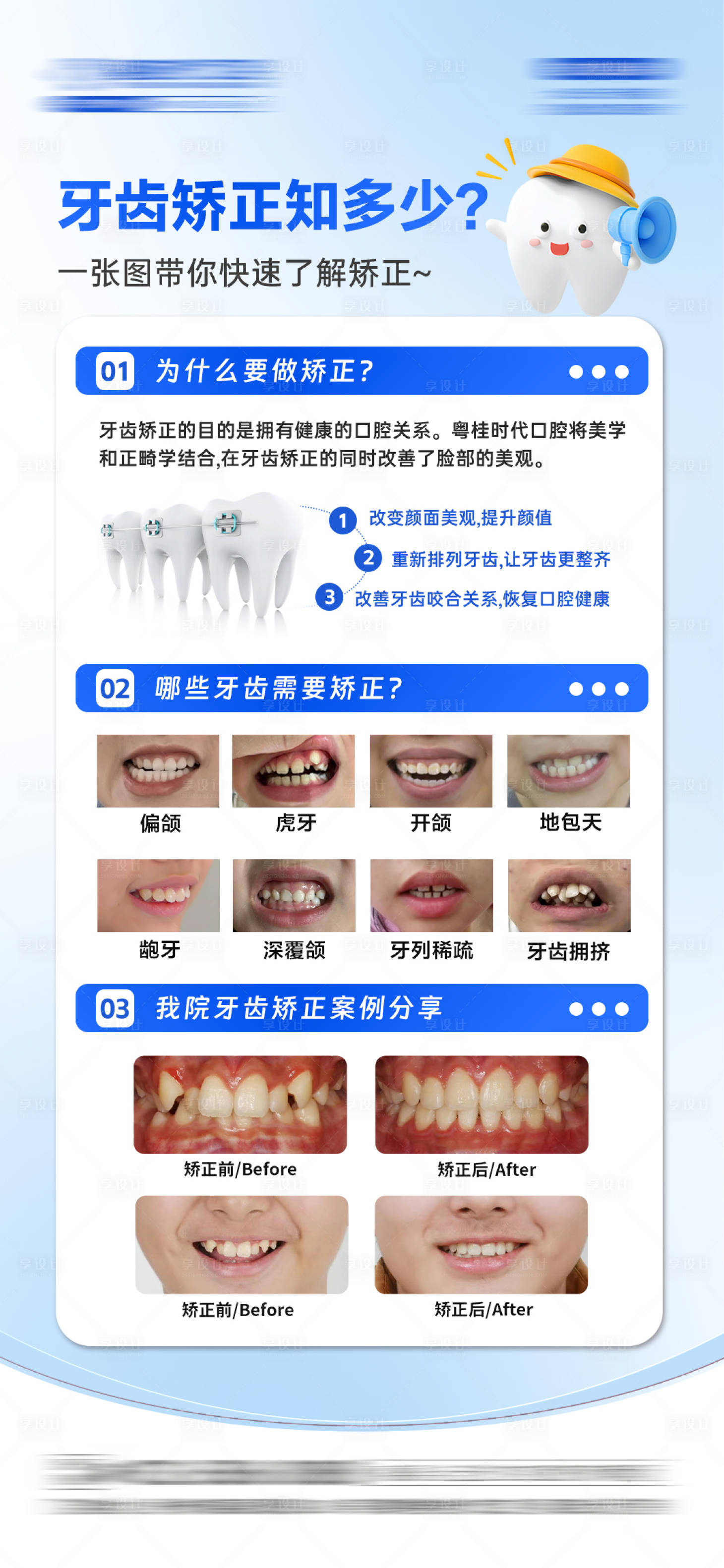 源文件下载【享设计】搜索编号：80840036752069190【牙齿矫正科普宣传海报】