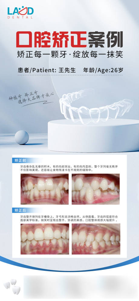 源文件下载【享设计】搜索编号：61320036757768018【口腔矫正案例h5朋友圈海报】