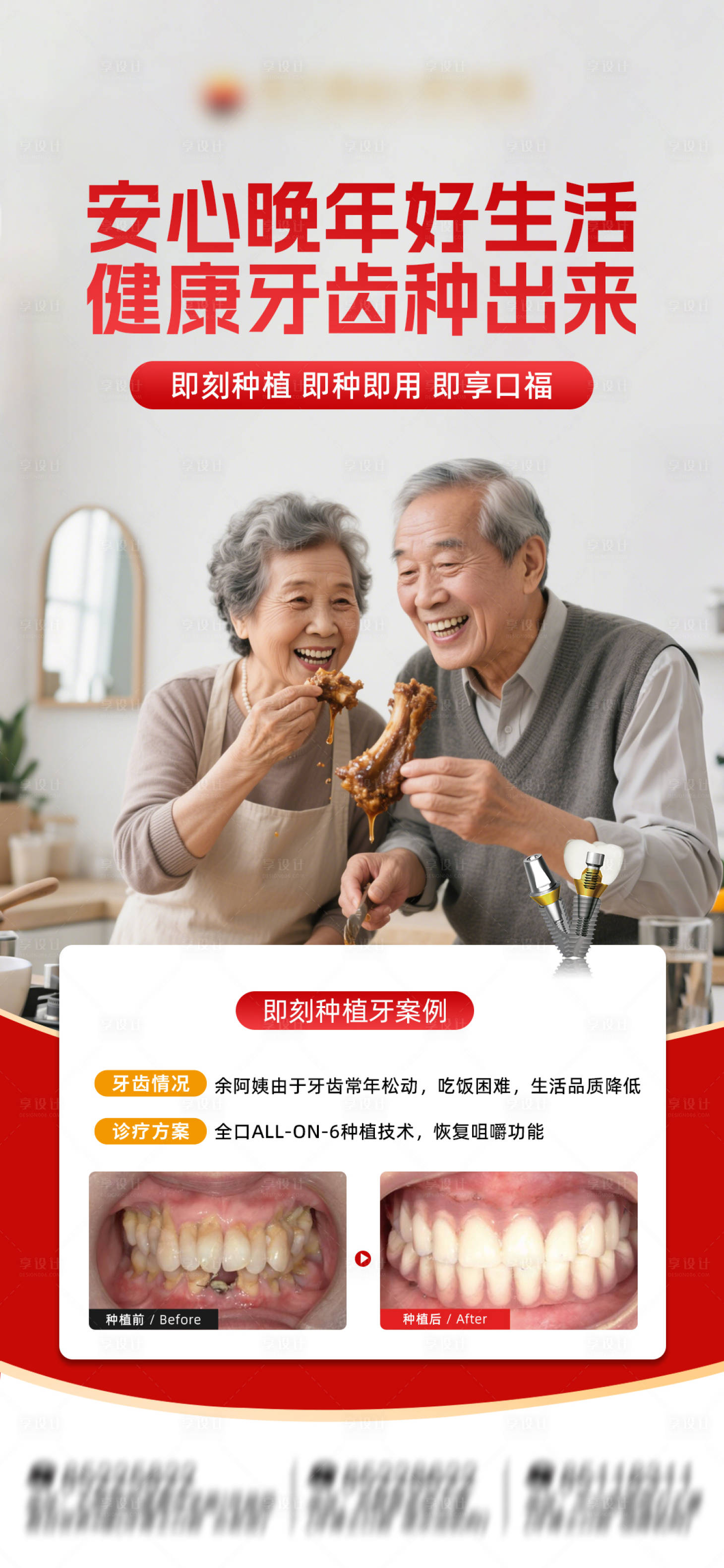 源文件下载【享设计】搜索编号：31070036737536039【口腔种植牙案例海报】