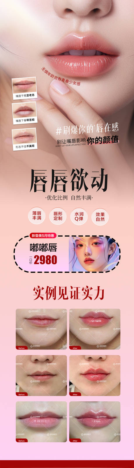 源文件下载【享设计】搜索编号：58680036793451465【医美丰唇海报】