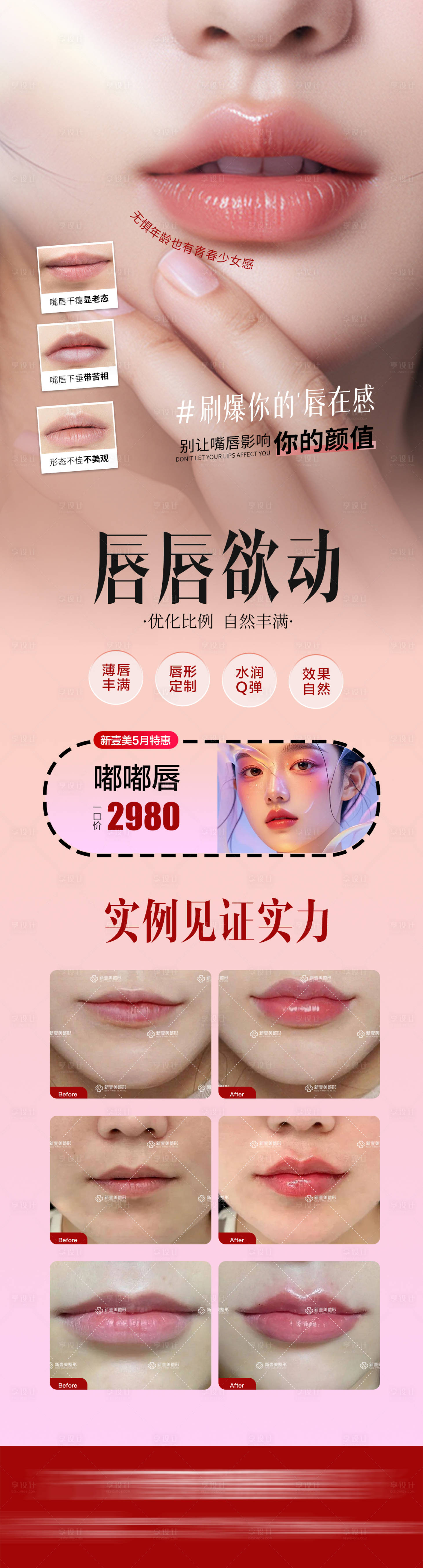 源文件下载【享设计】搜索编号：58680036793451465【医美丰唇海报】