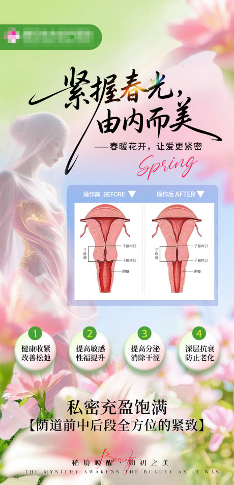 源文件下载【享设计】搜索编号：34750036664657986【医美妇科私密海报】