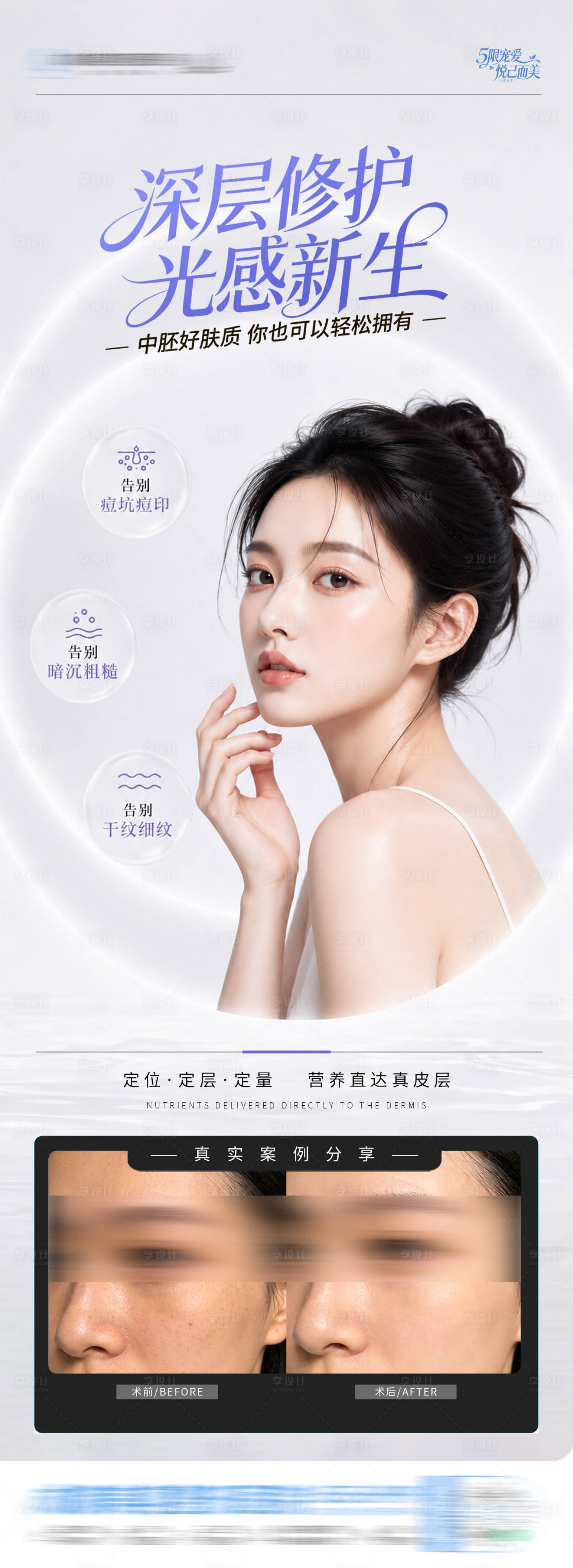 源文件下载【享设计】搜索编号：47650036700735880【医美皮肤中胚层深层修护案例创意海报】