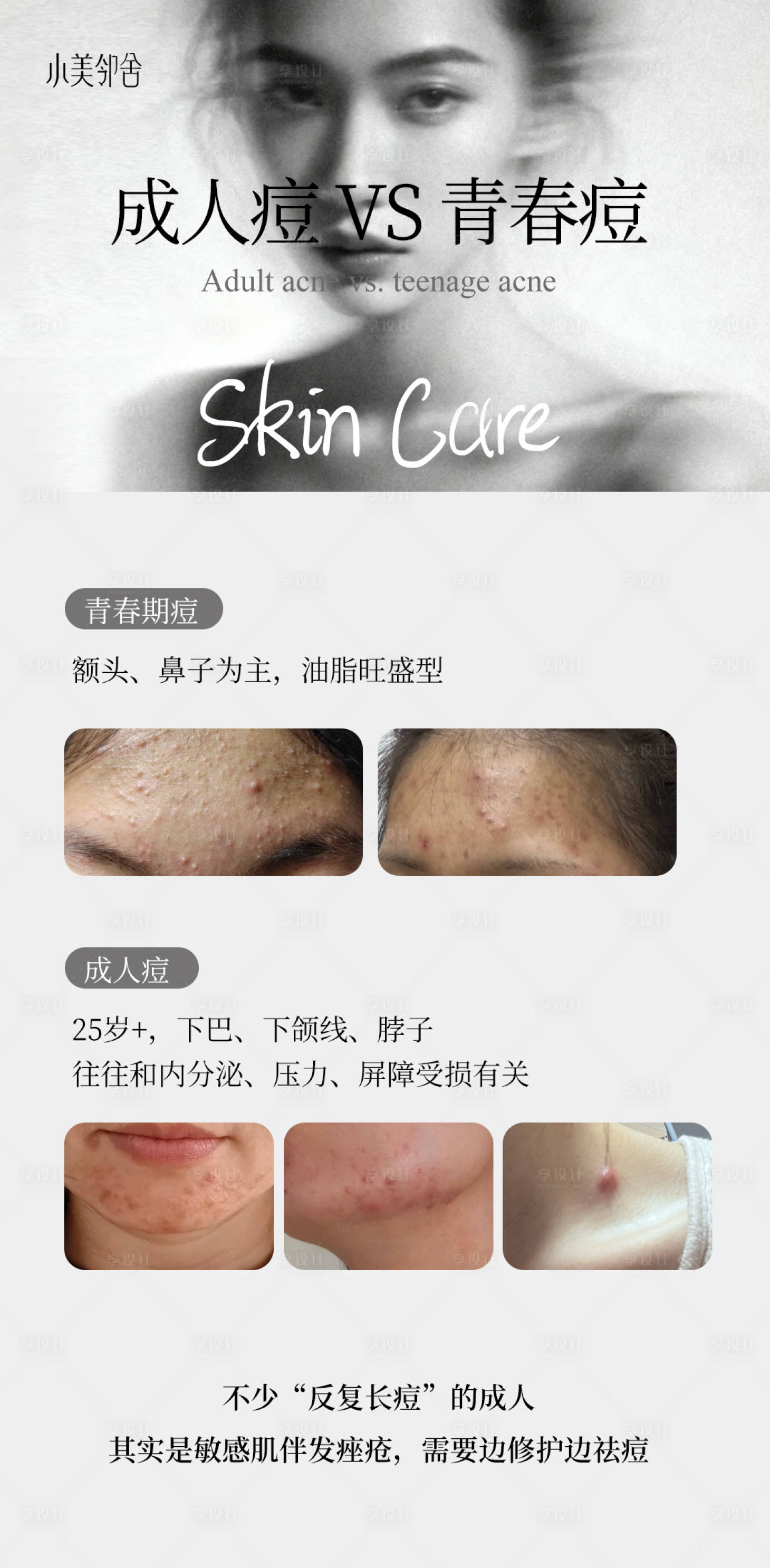 源文件下载【享设计】搜索编号：99120036848628469【高级护肤品海报  】