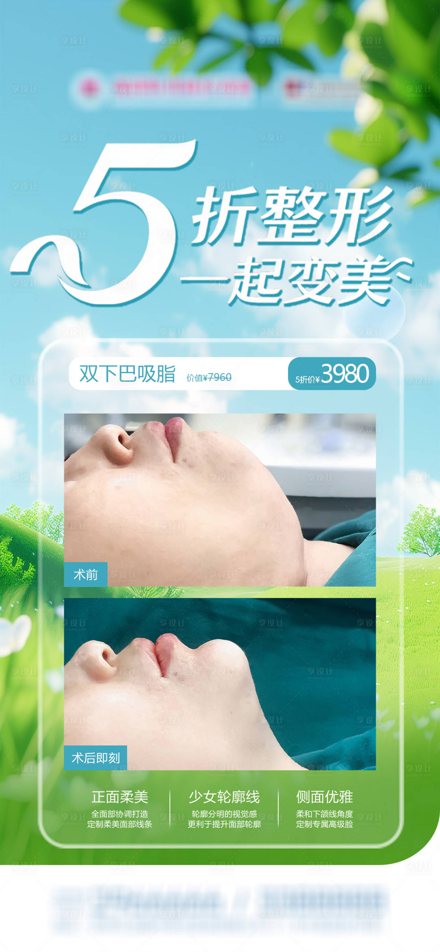 源文件下载【享设计】搜索编号：37410036668786648【双下巴吸脂案例对比及优惠海报】