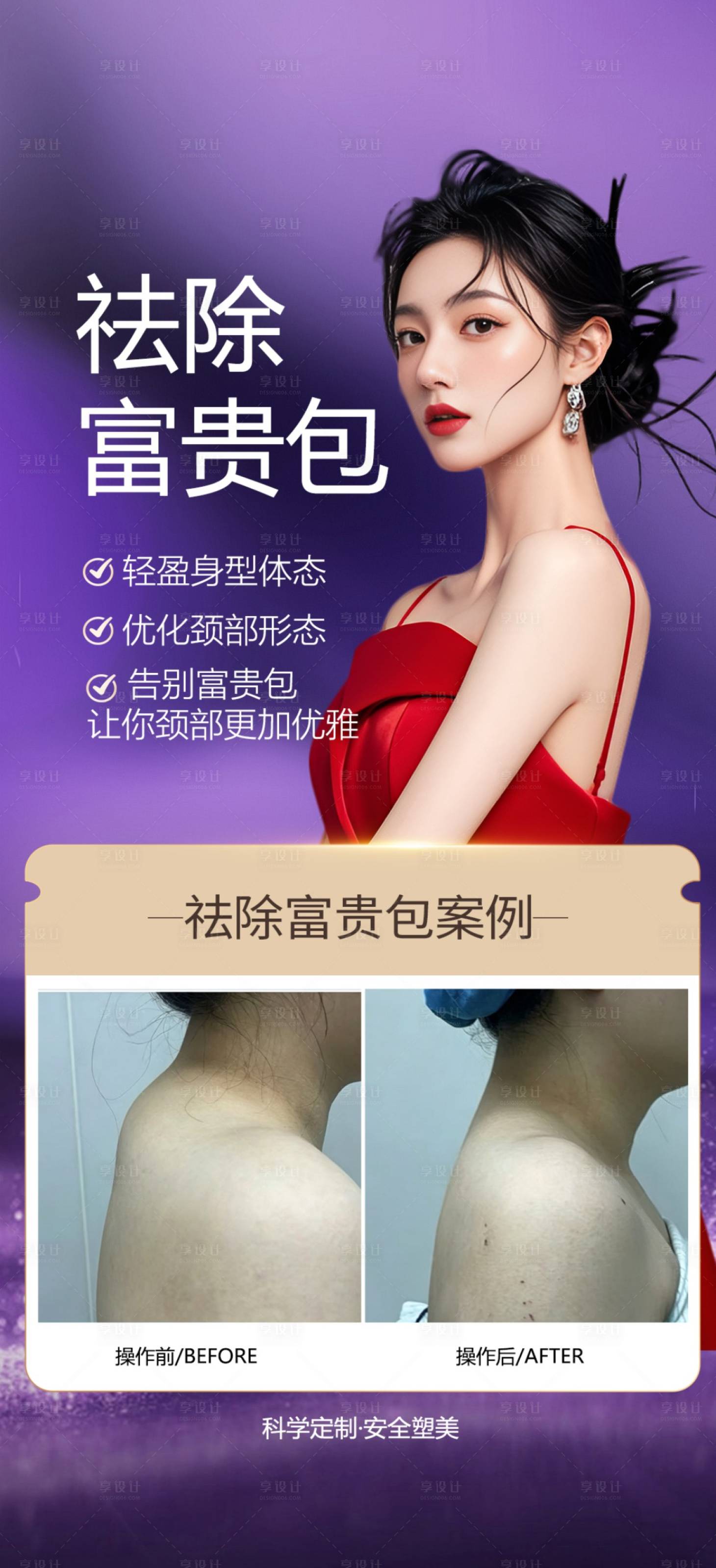 源文件下载【享设计】搜索编号：38120036663784100【医美海报】