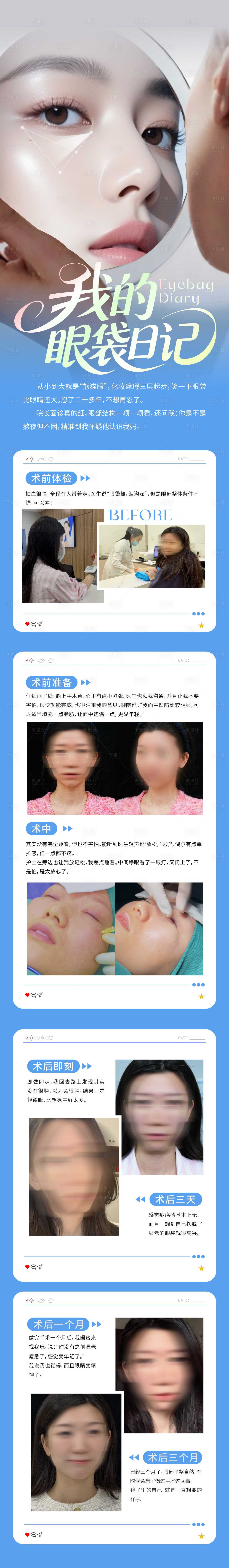源文件下载【享设计】搜索编号：47970036653271182【医美眼袋案列对比长图】