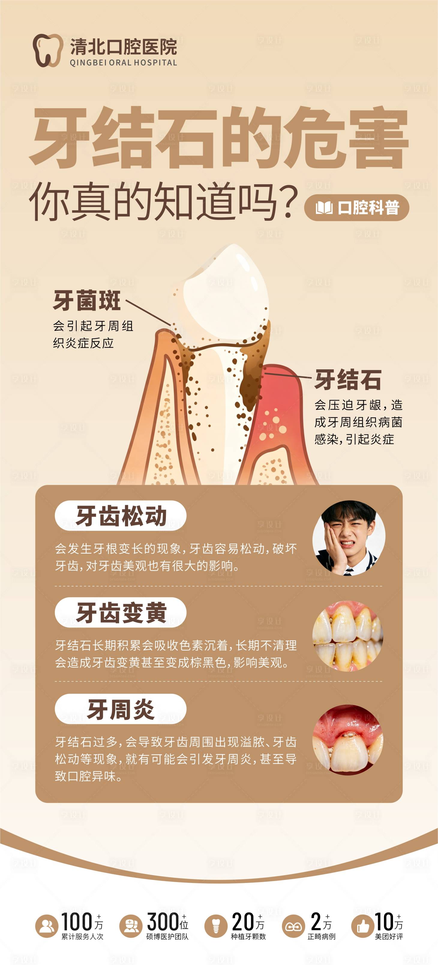 源文件下载【享设计】搜索编号：99560037171853355【口腔科普牙结石的危害海报】