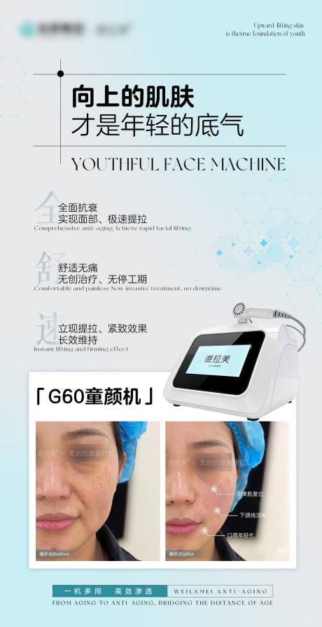 源文件下载【享设计】搜索编号：21800037132439573【定格年轻童颜机案例海报】