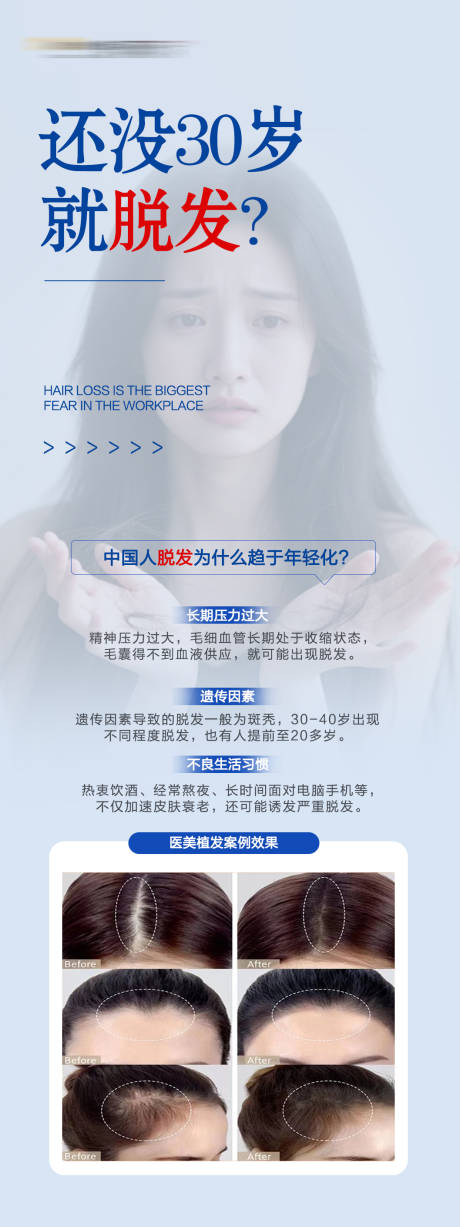 源文件下载【享设计】搜索编号：98410037388262408【医美治疗脱发前后对比海报】
