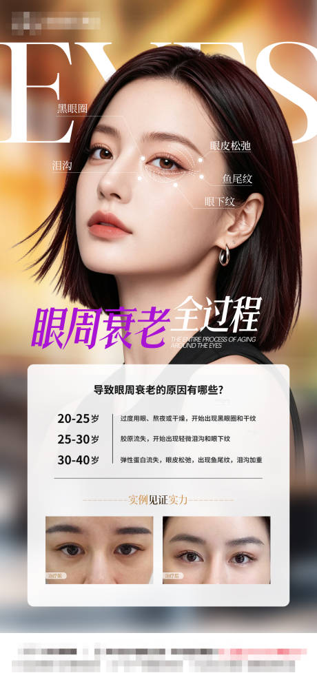 源文件下载【享设计】搜索编号：45720037759949642【医美眼周眼周年轻化】
