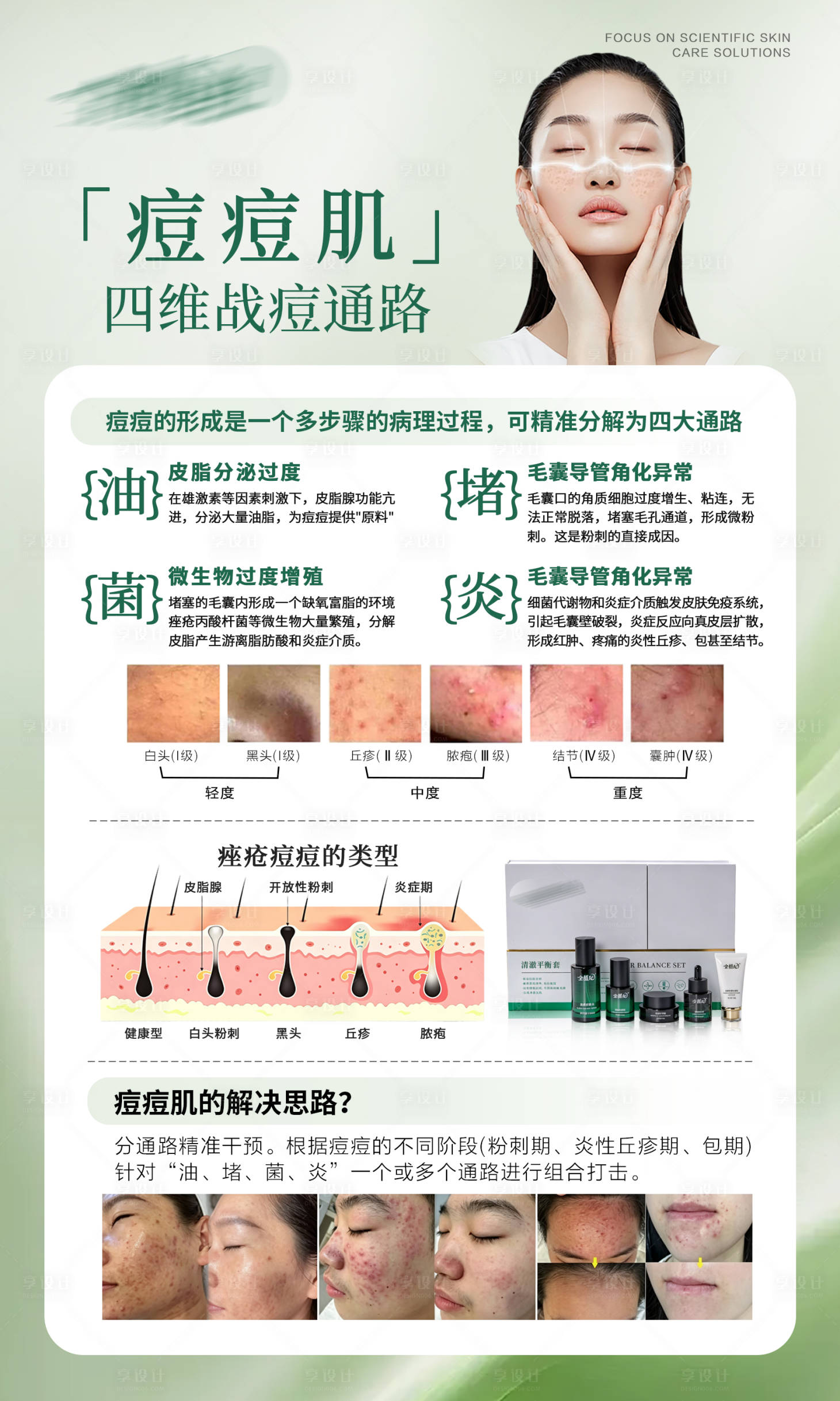源文件下载【享设计】搜索编号：68180037924596505【痘痘肌】
